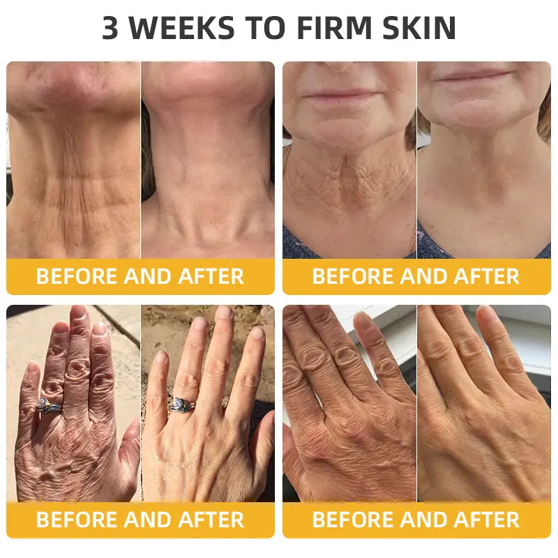 ๐๐๐๐ฅ๐ซ๐ข๐ณ๐ยฎ ๐๐๐๐ ๐๐๐+ ๐๐๐ ๐๐ง๐๐ซ๐๐ญ๐ข๐ฏ๐ ๐๐๐ฉ๐๐ข๐ซ ๐๐จ๐ญ๐ข๐จ๐ง