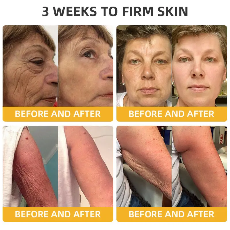 ๐๐๐๐ฅ๐ซ๐ข๐ณ๐ยฎ ๐๐๐๐ ๐๐๐+ ๐๐๐ ๐๐ง๐๐ซ๐๐ญ๐ข๐ฏ๐ ๐๐๐ฉ๐๐ข๐ซ ๐๐จ๐ญ๐ข๐จ๐ง