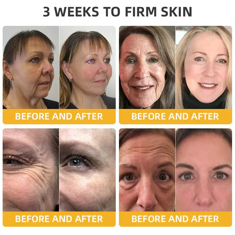 ๐๐๐๐ฅ๐ซ๐ข๐ณ๐ยฎ ๐๐๐๐ ๐๐๐+ ๐๐๐ ๐๐ง๐๐ซ๐๐ญ๐ข๐ฏ๐ ๐๐๐ฉ๐๐ข๐ซ ๐๐จ๐ญ๐ข๐จ๐ง