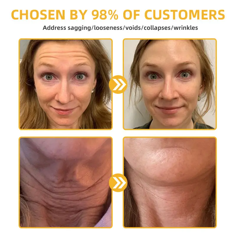 ๐๐๐๐ฅ๐ซ๐ข๐ณ๐ยฎ ๐๐๐๐ ๐๐๐+ ๐๐๐ ๐๐ง๐๐ซ๐๐ญ๐ข๐ฏ๐ ๐๐๐ฉ๐๐ข๐ซ ๐๐จ๐ญ๐ข๐จ๐ง