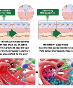 Healrize® 𝑴𝒐𝒓𝒊𝒏𝒈𝒂 & 𝑩𝒆𝒓𝒃𝒆𝒓𝒊𝒏𝒆 20-𝑰𝑵-1 𝑨𝒅𝒗𝒂𝒏𝒄𝒆𝒅 𝑵𝒂𝒏𝒐 𝑴𝒊𝒄𝒓𝒐𝒏𝒆𝒆𝒅𝒍𝒆 𝑷𝒂𝒕𝒄𝒉