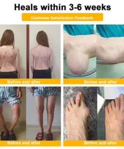 Healrize® BEE VENOM LITHOSPERMUM Pain-Relief Bone Healing Cream