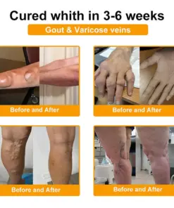 Healrize® BEE VENOM LITHOSPERMUM Pain-Relief Bone Healing Cream