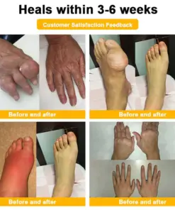 Healrize® BEE VENOM LITHOSPERMUM Pain-Relief Bone Healing Cream