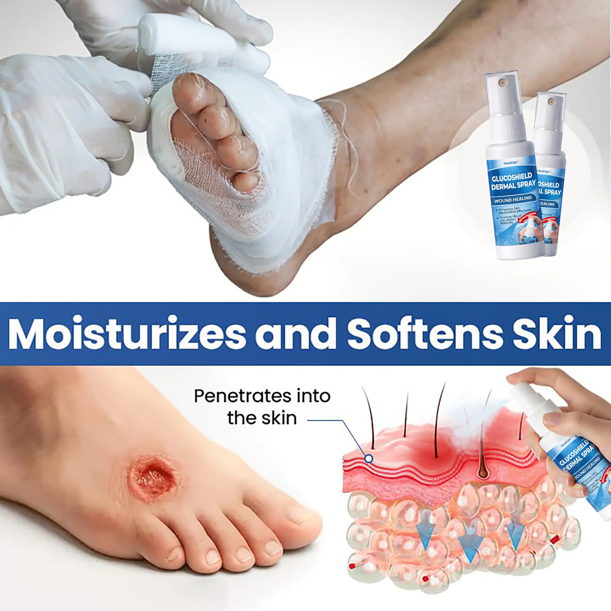 Healrize® GlucoShield Dermal Spray