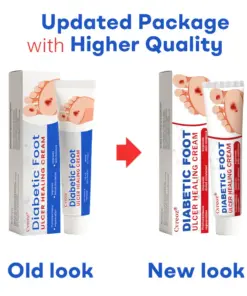 Healrize® Diabetic Foot Ulcer Healing Cream