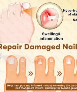 Healrize® NailRescue BeeVenom Renewal Spray