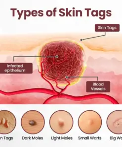 Healrize® BLACK RICE DUAL-ACTION RENEWAL CREAM