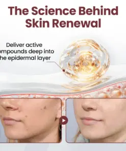 Healrize® BLACK RICE DUAL-ACTION RENEWAL CREAM