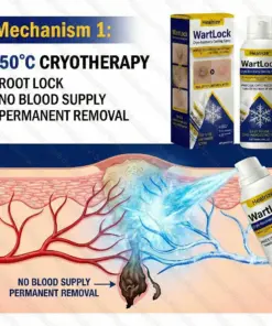 Healrize® WartLock Cryo-Recovery Cooling Spray