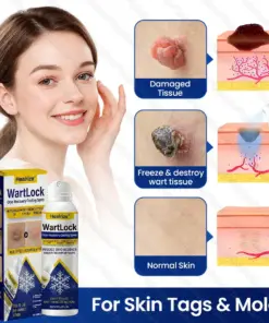 Healrize® WartLock Cryo-Recovery Cooling Spray