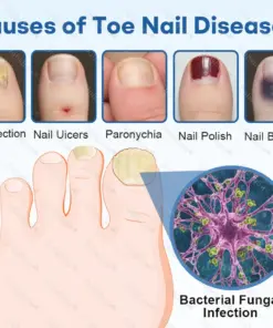Healrize®Nano Rapid Clear Nail Fungus Rapair Liquid Effective in Seven Days, Permanently Eliminates the Root
