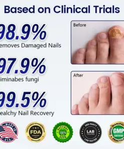 Healrize® Anti-Fungal Nail Repair Patch