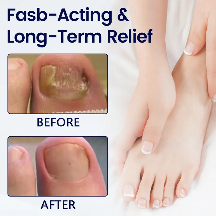 Healrize® Anti-Fungal Nail Repair Patch