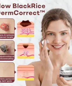 Healrize® BlackRice DermCorrect™ Wart Recovery Cream Suitable for all skin types