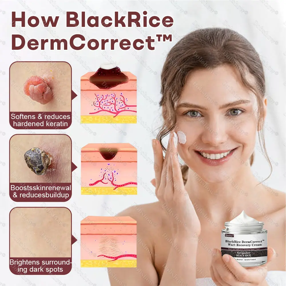 Healrize® BlackRice DermCorrect™ Wart Recovery Cream Suitable for all skin types