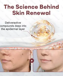 Healrize® BlackRice DermCorrect™ Wart Recovery Cream Suitable for all skin types