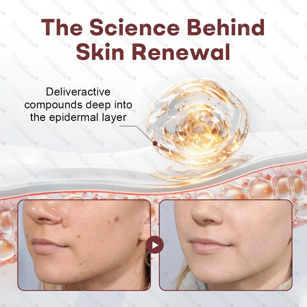 Healrize® BlackRice DermCorrect™ Wart Recovery Cream Suitable for all skin types