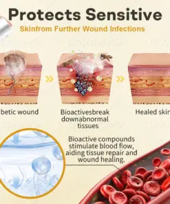 Healrize® GlucoShield Bee Venom Wound Spray1 Best-Selling Wound Care Spray