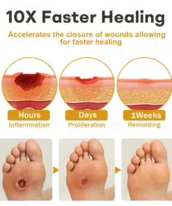 Healrize® GlucoShield Bee Venom Wound Spray1 Best-Selling Wound Care Spray