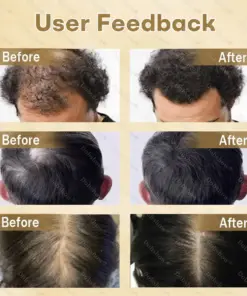 Healrize® Hair Regrowth Capsules Nano Penetration, Deep into Hair Roots