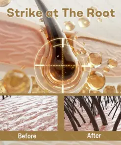 Healrize® Hair Regrowth Capsules Nano Penetration, Deep into Hair Roots