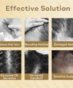 Healrize® Hair Regrowth Capsules Newly Upgraded,Nano Penetration, Deep into Hair Roots