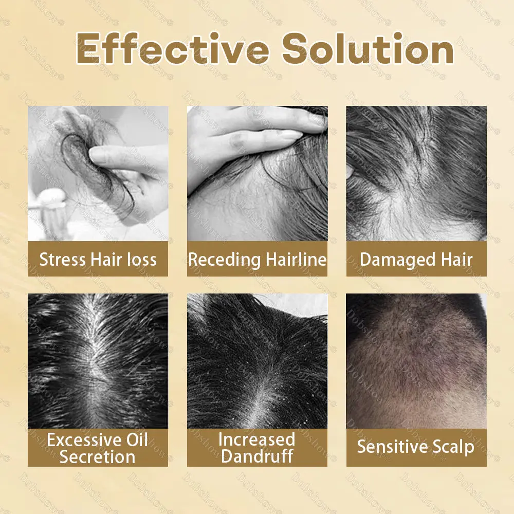 Healrize® Hair Regrowth Capsules Newly Upgraded,Nano Penetration, Deep into Hair Roots