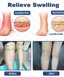 Healrize® LymphaPure Deep Drainage Therapy