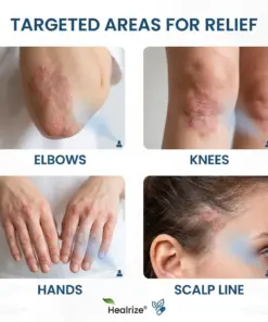 Healrize® Magnesium Botanical Spray