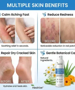 Healrize® Magnesium Botanical Spray