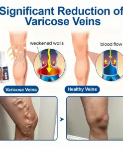 Healrize® Nano-Liposomal Vascular Intervention (FDA-Registered Molecular Repair)