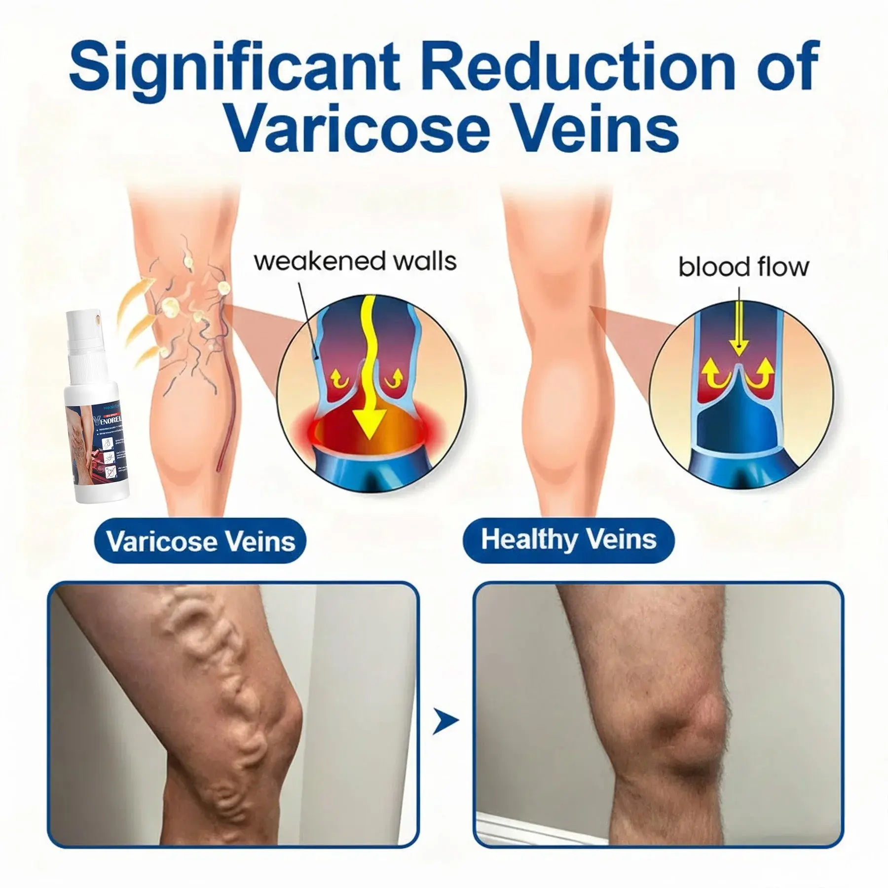 Healrize® Nano-Liposomal Vascular Intervention (FDA-Registered Molecular Repair)