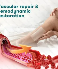 Healrize® Rapid Vein Relief Microdarts