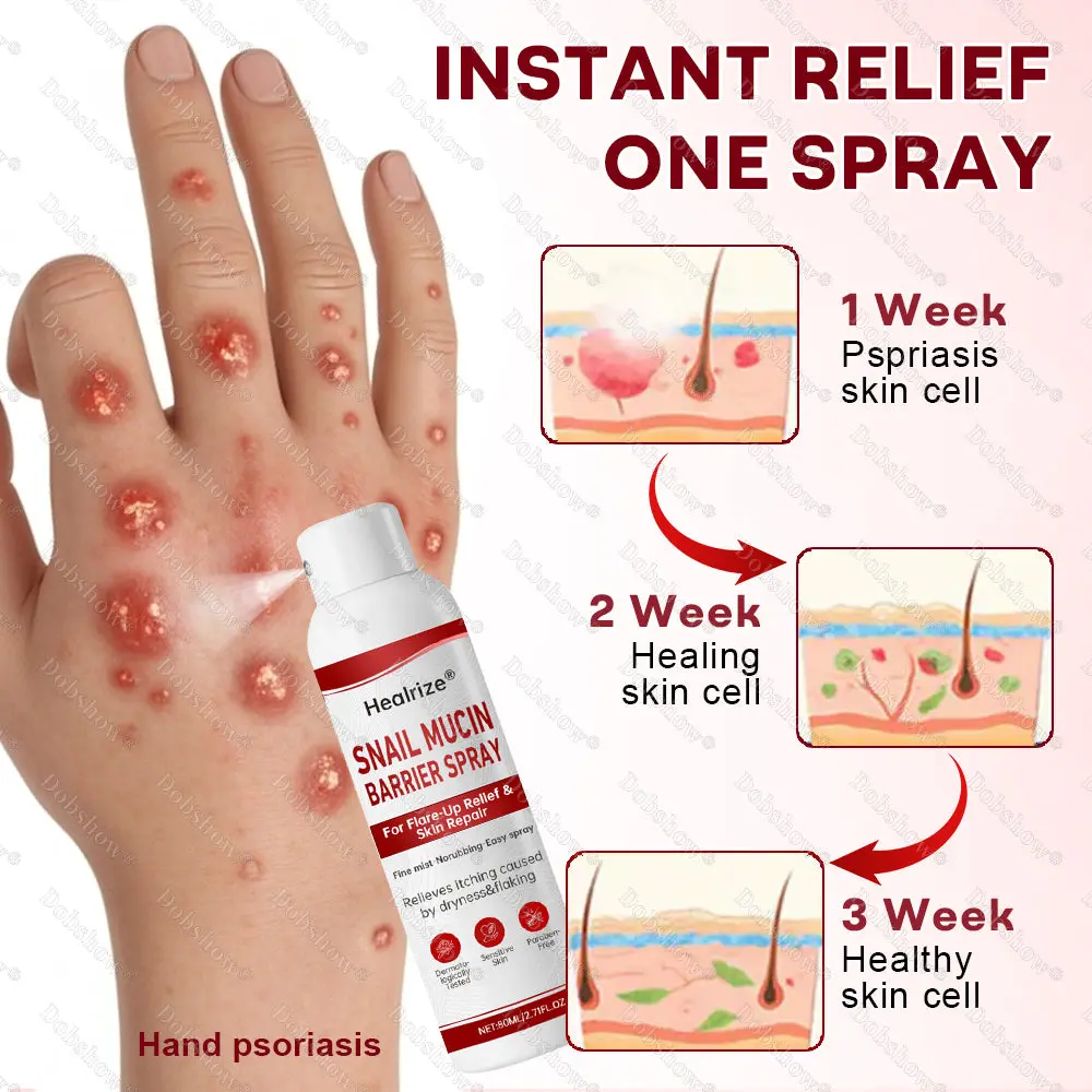 Healrize® Snail Mucin Barrier Spray for Flare-Up Relief & Skin Repair