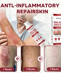 Healrize® Snail Mucin Barrier Spray for Flare-Up Relief & Skin Repair