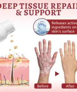 Healrize® Snail Mucin Healing Spray