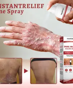 Healrize® Snail Mucin Healing Spray