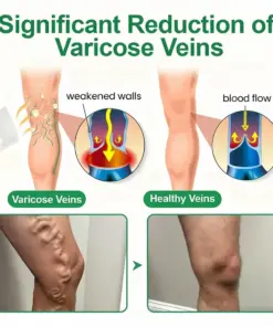 Healrize® VeinEase Microneedle Care PatchInstant Relief, Long-Term Results