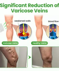 Healrize® VeinHeal Microneedle Patch