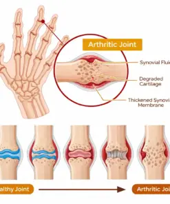 Healrize®Bee Venom Bone Healing Pain-Relief Cream