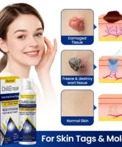 Healrize®ChillErase Gentle Bump Renewal Spray