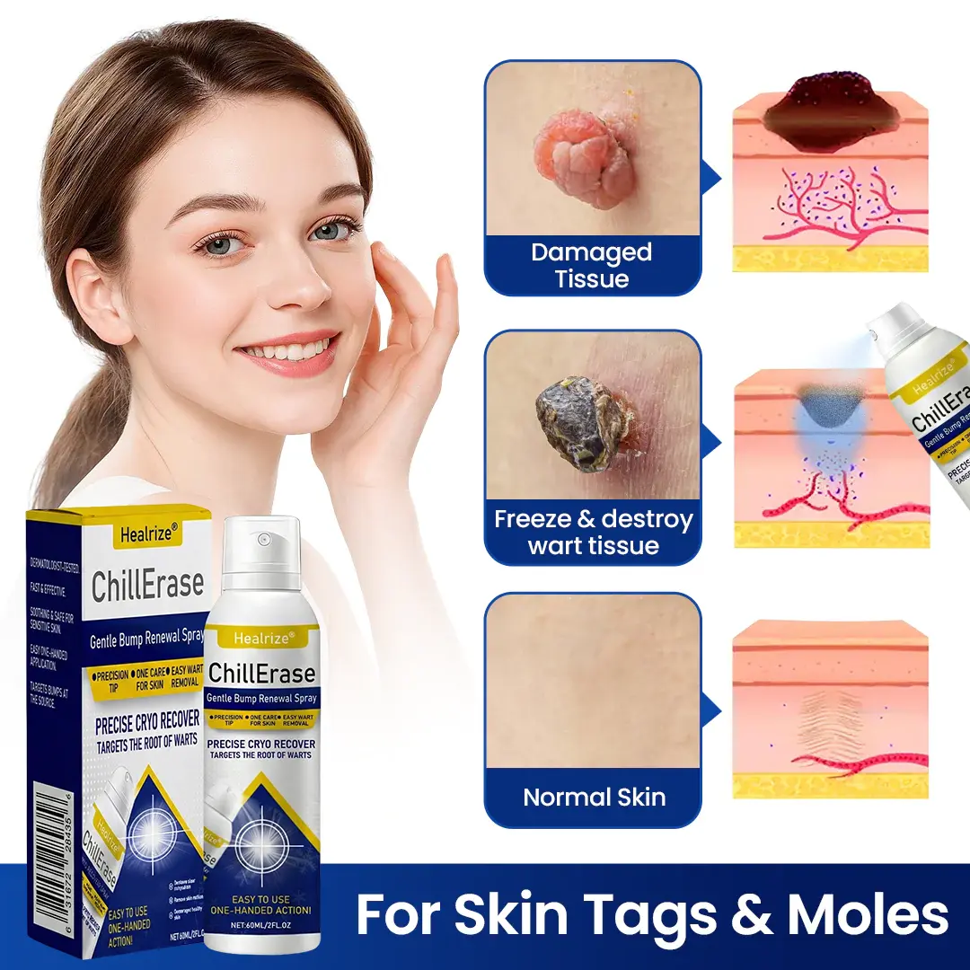 Healrize®ChillErase Gentle Bump Renewal Spray