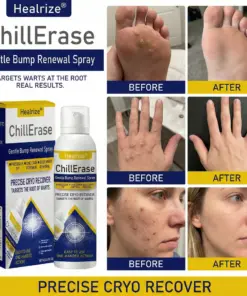 Healrize®ChillErase Gentle Bump Renewal Spray