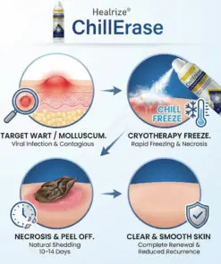 Healrize®ChillErase Gentle Bump Renewal Spray