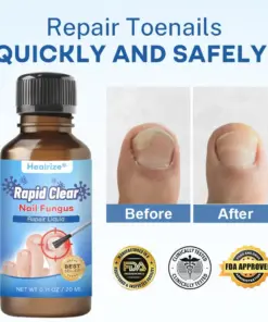 Healrize®Nano Rapid Clear Nail Fungus Rapair Liquid Effective in 7 Days, Permanently Eliminates the Root