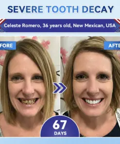 𝐇𝐞𝐚𝐥𝐫𝐢𝐳𝐞® Tideglusib Fast‑Dissolving Tooth & Gum Repair Oral Strips