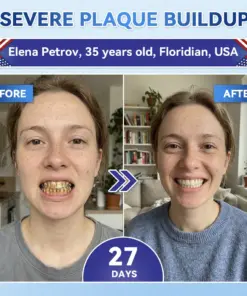 𝐇𝐞𝐚𝐥𝐫𝐢𝐳𝐞® Tideglusib Fast‑Dissolving Tooth & Gum Repair Oral Strips