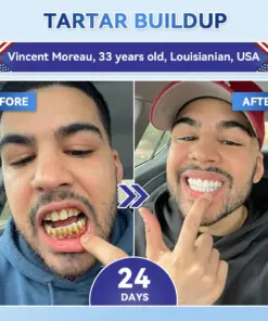 𝐇𝐞𝐚𝐥𝐫𝐢𝐳𝐞® Tideglusib Fast‑Dissolving Tooth & Gum Repair Oral Strips