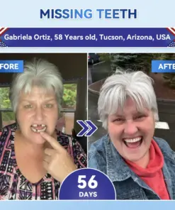 𝐇𝐞𝐚𝐥𝐫𝐢𝐳𝐞® Tideglusib Fast‑Dissolving Tooth & Gum Repair Oral Strips